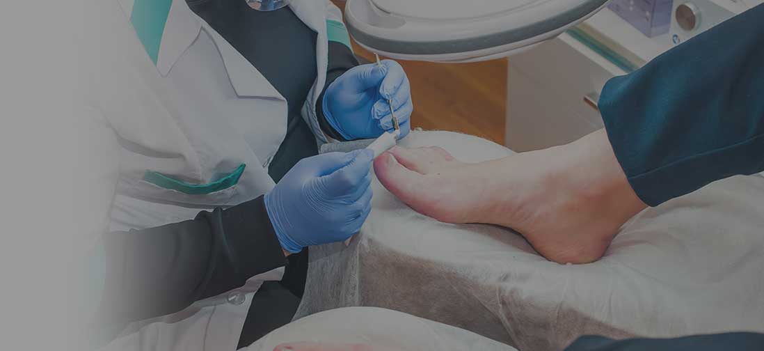 Doctor applying ointment to a toe.